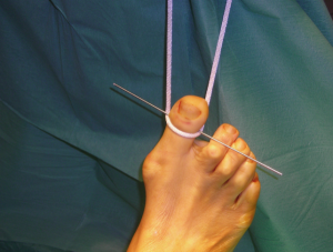 Schermata 2016-04-02 alle 17.08.19