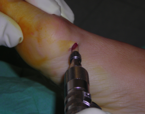 Schermata 2016-04-02 alle 17.09.46