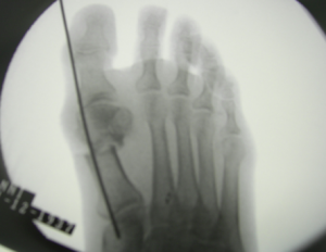 Schermata 2016-04-02 alle 17.10.19