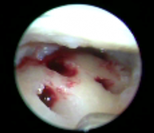 Schermata 2016-04-03 alle 17.36.08