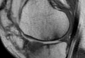 Schermata 2016-04-03 alle 17.50.27