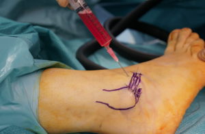 Schermata 2016-04-03 alle 18.08.43