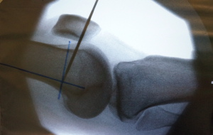 Schermata 2016-04-03 alle 18.22.30