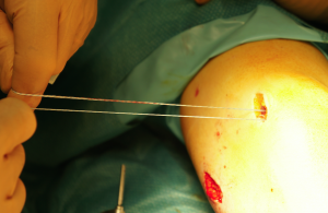 Schermata 2016-04-03 alle 18.23.28