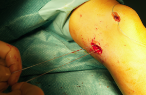 Schermata 2016-04-03 alle 18.23.43