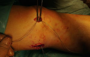 Schermata 2016-04-03 alle 18.23.52