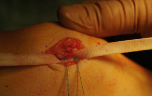 Schermata 2016-04-03 alle 18.24.02