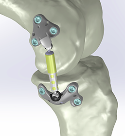 Schermata 2016-04-13 alle 21.51.57